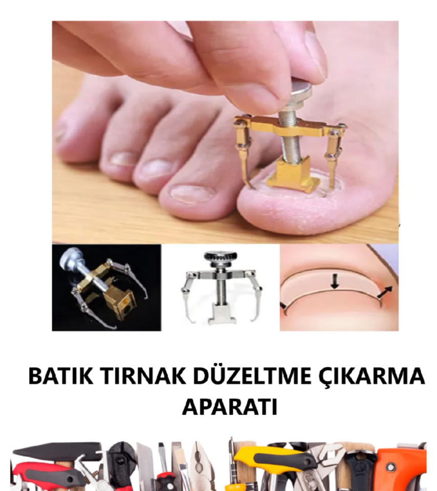 BATIK TIRNAK DÜZELTME ÇIKARMA APARATI